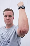 RISIKO: Jonathan Syverstad fikk avslitt sener og nervetråder under øvelse.  Det gjør vondt ennå