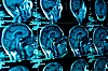 POPULÆR E-TJENESTE: Både heldøgnsbrukere og personer som skal i avlastning formidles via kommunenes åpne anbudsutlysninger på nett. (Bilde av MRI-scanning)